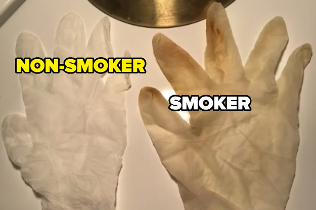 16-side-by-side-photos-that-show-the-difference-between-smokers-and-non-smokers