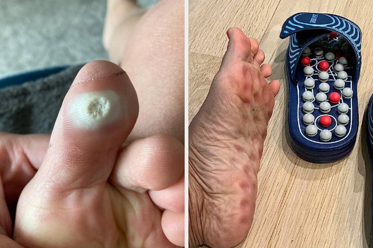 fair-warning-if-foot-pictures-kinda-disgust-you-—-here-are-38-products-made-just-for-feet